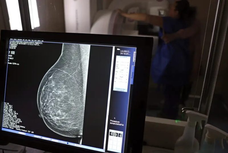 Médicos lançam guia para evitar recusa de mamografia digital