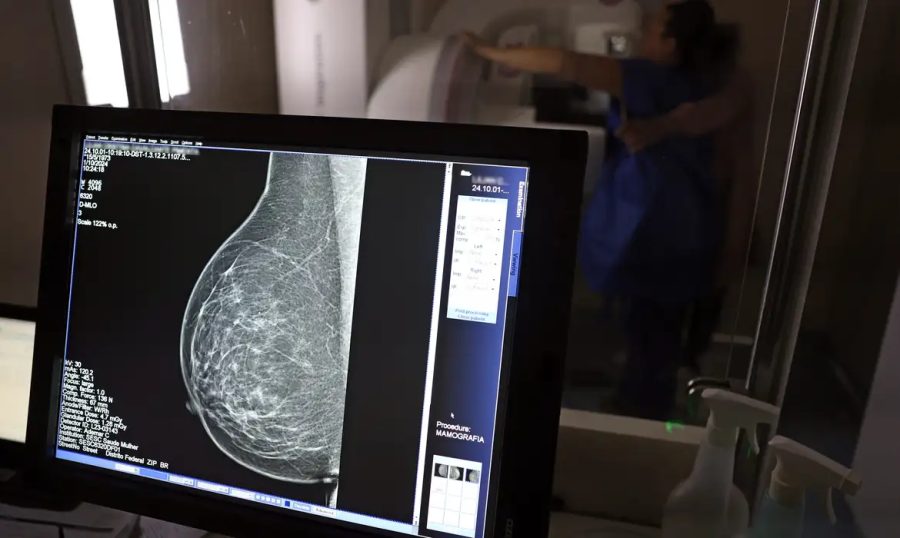 Médicos lançam guia para evitar recusa de mamografia digital